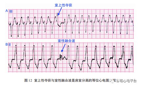 深圳积分入户个人进度无法查询_2022年深圳市入户个人所得税纳税积分_深圳个人积分入户流程